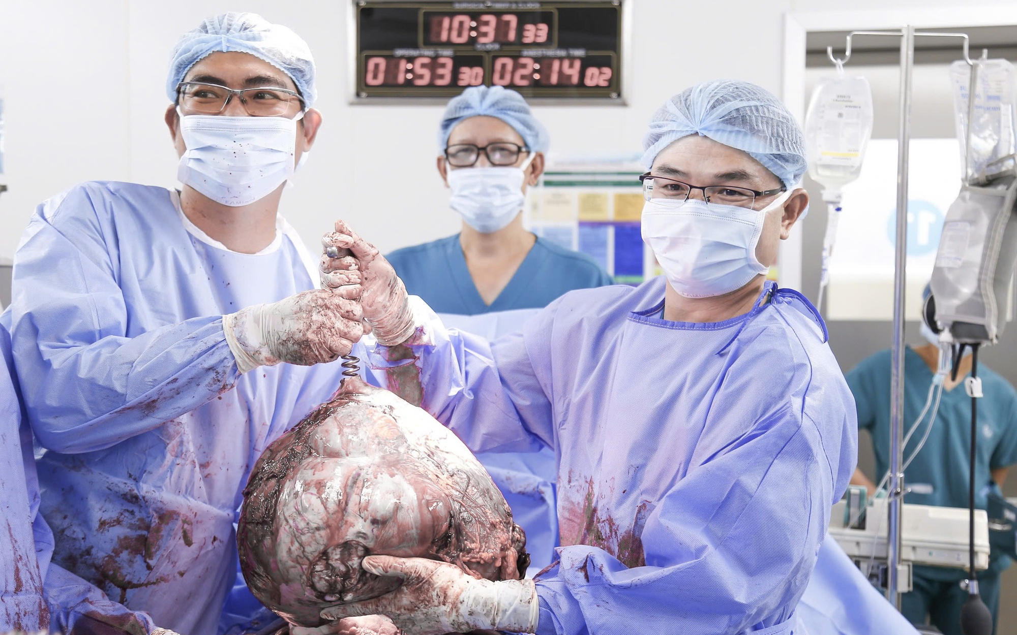 Bóc tách khối u nặng gần 3kg trong bụng người phụ nữ 51 tuổi- Ảnh 2.