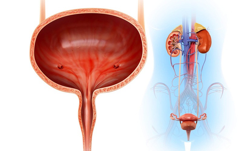 Thói quen xấu gây sỏi bàng quang, những sai lầm thường gặp 1 20201005dau hieu soi bang quang 1 17091290649031028715716 10 0 510 800 crop 1774532306723192942135
