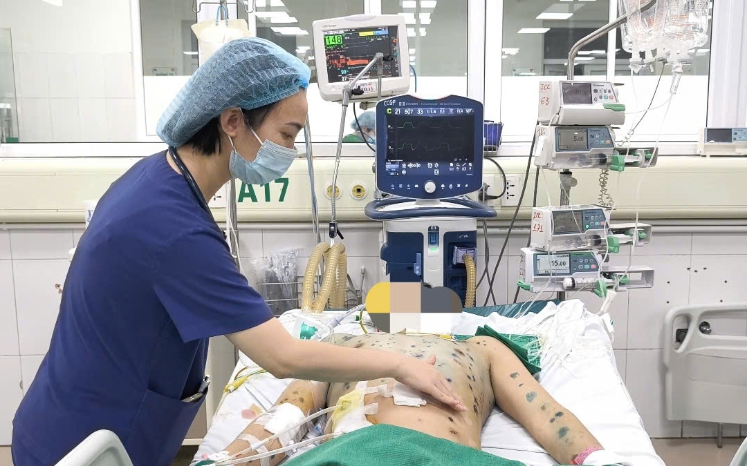 Cùng lúc nhiễm nhiều loại giun sán, gan của cụ bà chứa toàn mủ đục- Ảnh 3. Cùng lúc nhiễm nhiều loại giun sán, gan của cụ bà chứa toàn mủ đục- Ảnh 3.