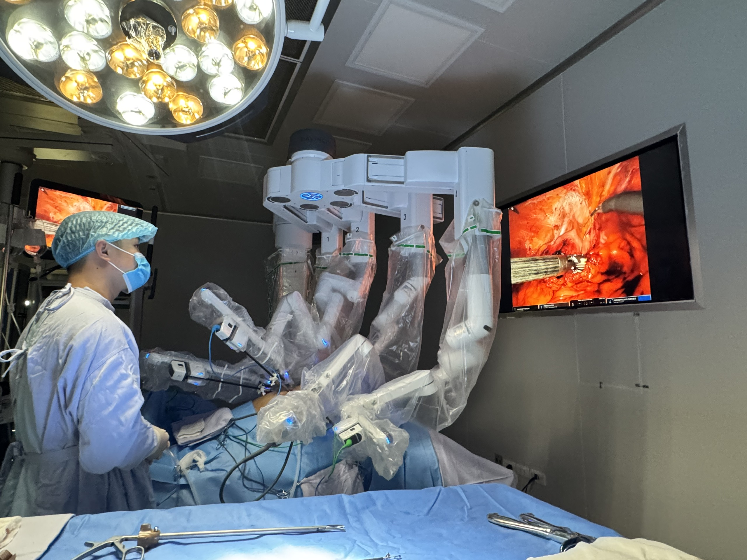 Hành trình 10 năm chiến đấu với ung thư và kỳ tích từ phẫu thuật robot- Ảnh 1.