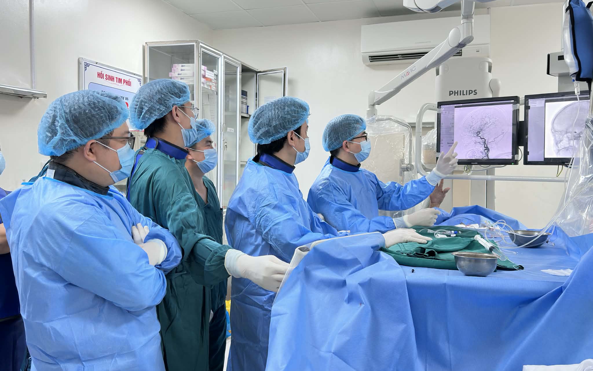 "Giải cứu" mắt lồi do rò động mạch cảnh xoang hang phức tạp bằng can thiệp nội mạch