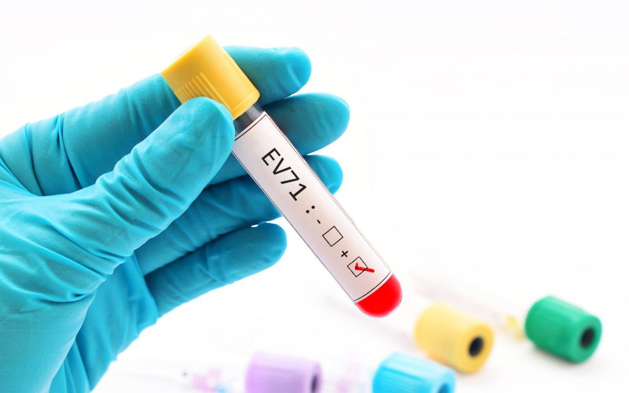 ev71 1400x788 17748801864411128887115 0 27 788 1288 crop 17749432114081302262410