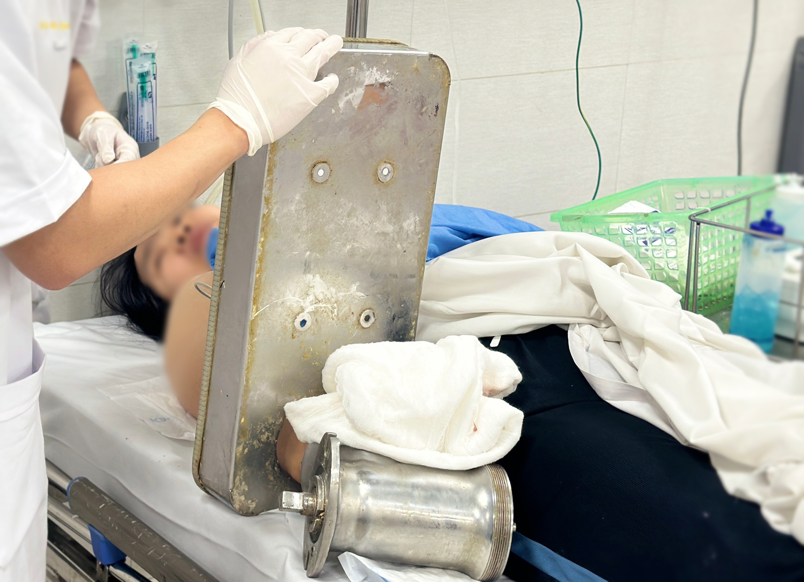 Người phụ nữ nhập viện với bàn tay vẫn còn kẹt nguyên trong máy xay thịt- Ảnh 1.