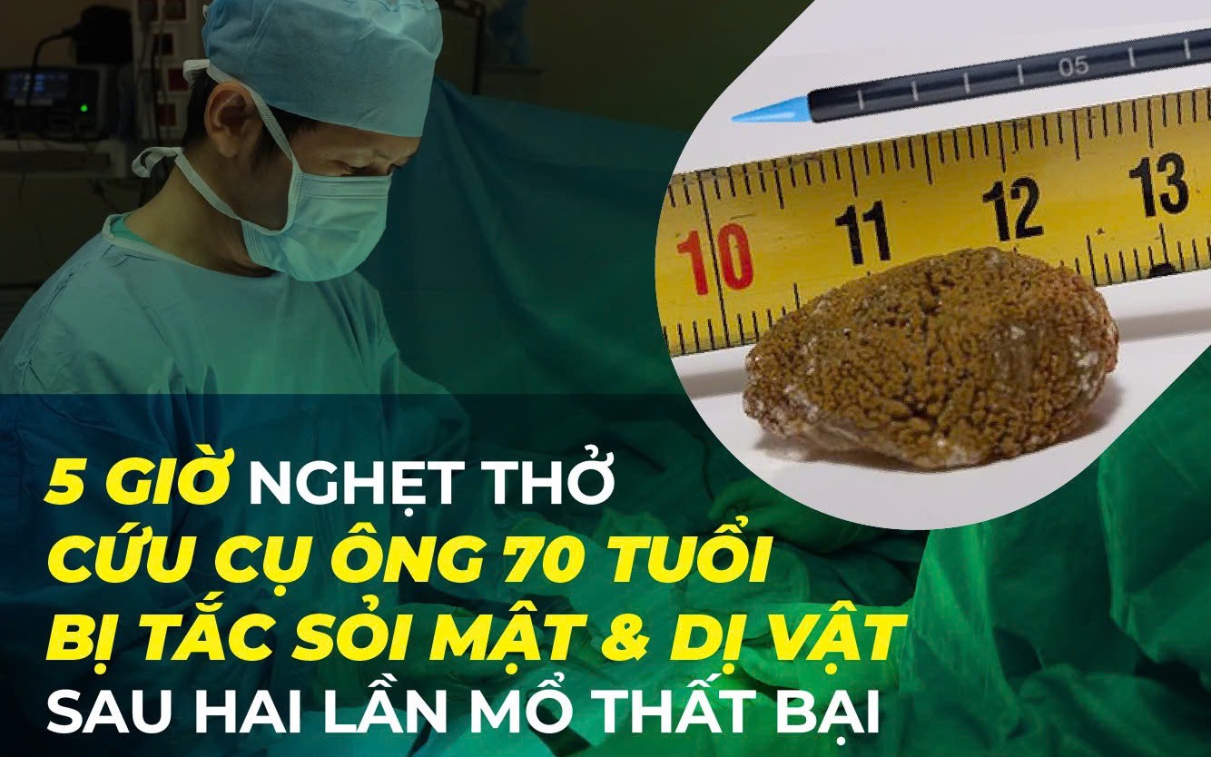 img3599 1772772954646828930120 82 0 916 1334 crop 17727729620221058706498