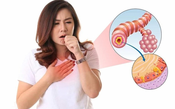 phe quan bi viem 1772793654971265008778 0 0 376 602 crop 1772793853245641048986