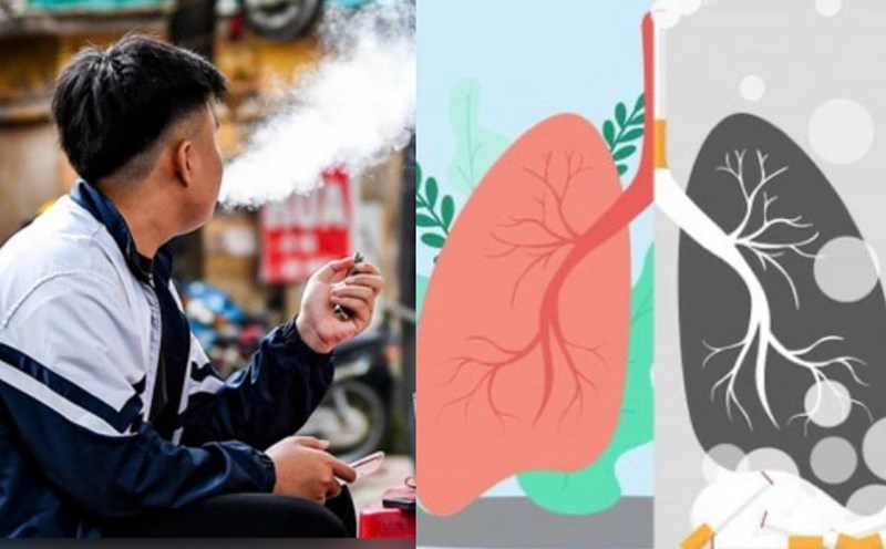Sửa luật để chặn 'làn sóng nghiện' thuốc lá mới - Ảnh 2.