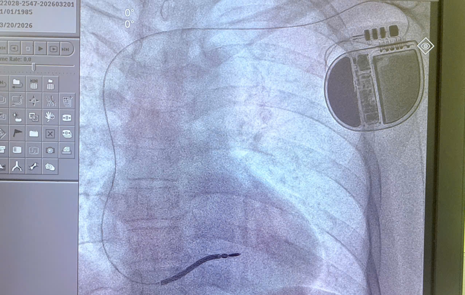 A man who fainted three times and suffered cardiac arrest once, facing ...