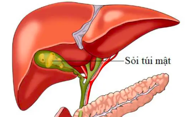benh soi tui mat 171237709229328280234 11 0 416 648 crop 17758317557351723442543