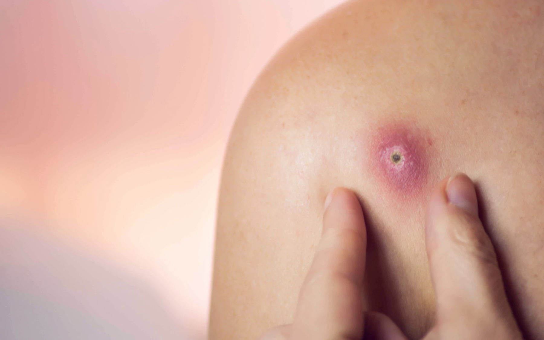 munnhotf74a008922 1775817521103 17758175215511263019498 0 0 1125 1800 crop 1775817600646592265499