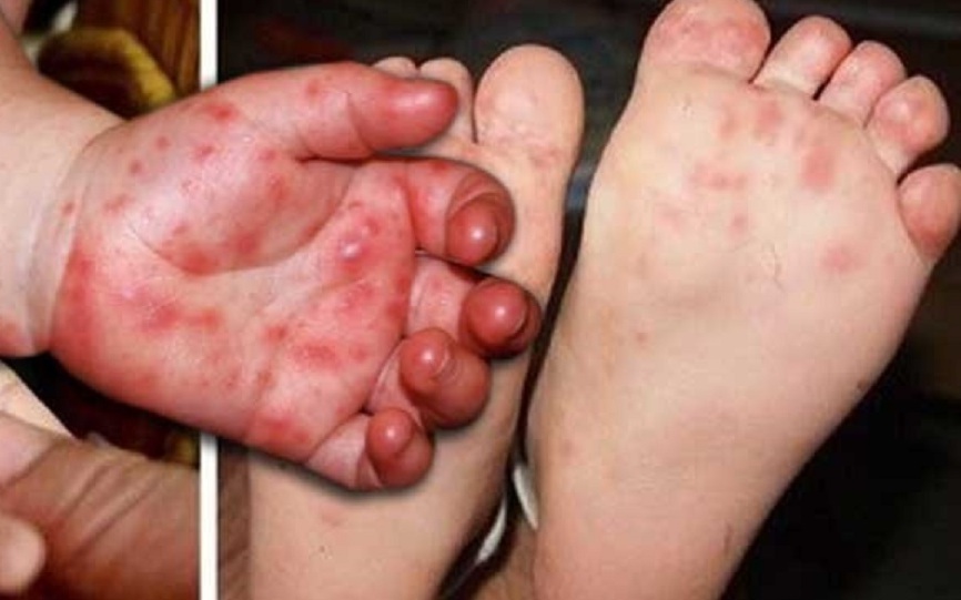 Chuyên gia y tế: Hô hấp có kiểm soát giúp điều hòa stress- Ảnh 3.