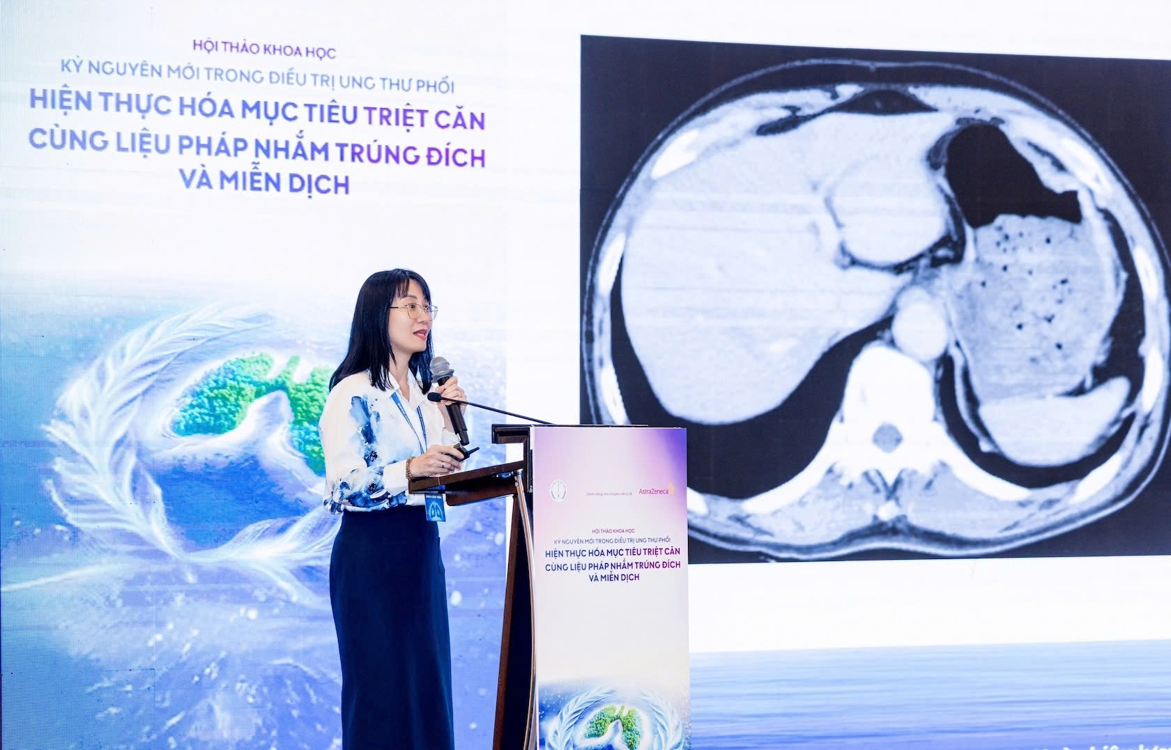 Bước tiến mới trong điều trị ung thư phổi giúp kéo dài chất lượng sống cho người bệnh- Ảnh 2. Bước tiến mới trong điều trị ung thư phổi giúp kéo dài chất lượng sống cho người bệnh- Ảnh 2.