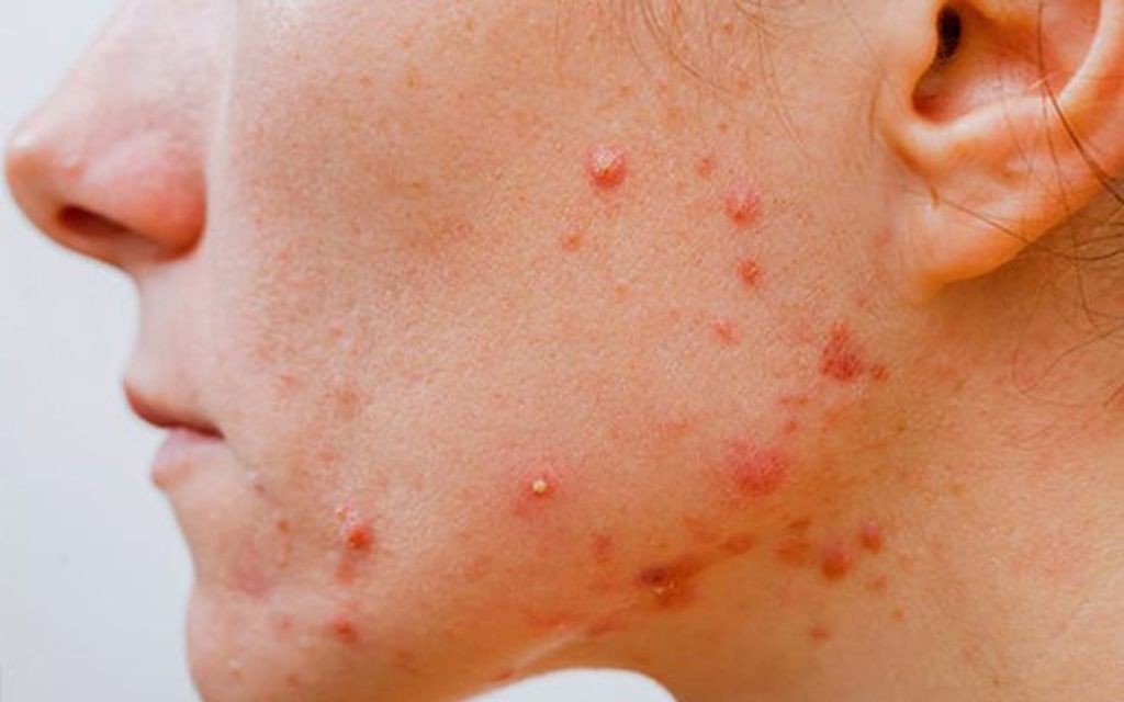 26d7d3a8b7c4130b01255297c18a40f71752777862 1776135322008 1776135323486828508509 0 0 640 1024 crop 1776135390465712509840