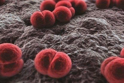 Bé 11 tuổi bị co giật do biến chứng viêm cầu thận sau viêm họng liên cầu- Ảnh 2. Bé 11 tuổi bị co giật do biến chứng viêm cầu thận sau viêm họng liên cầu- Ảnh 2.