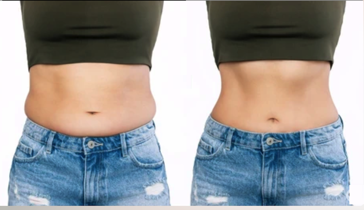 Giảm cân có phải là giảm béo?- Ảnh 1.