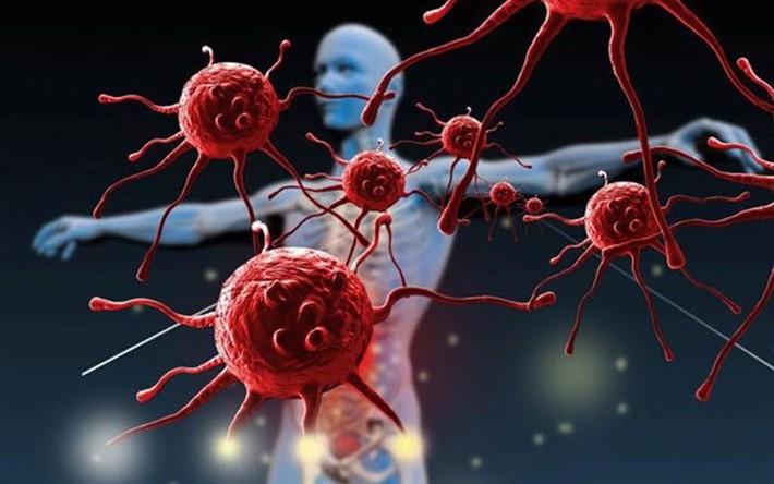 ung thu 1776355678250424699052 10 0 454 710 crop 177635578479630876648