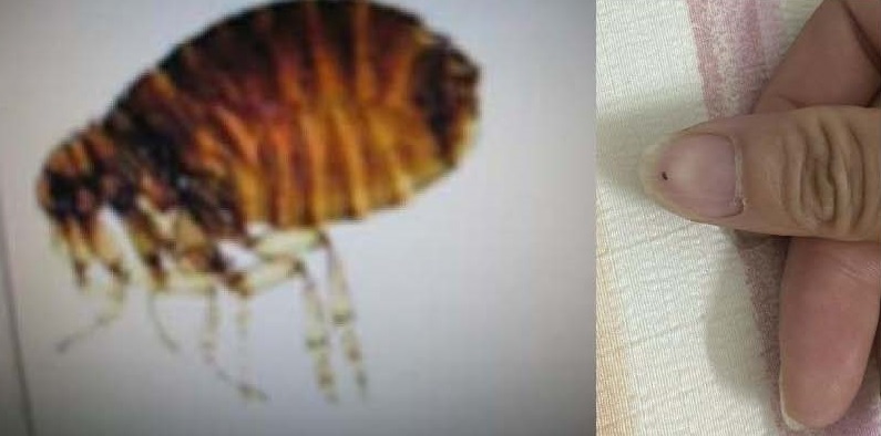 Viêm da do bọ chét: Dấu hiệu nhận biết sớm và cách xử lý tránh nhiễm trùng- Ảnh 1.