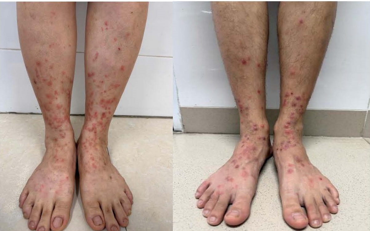 san ngua do bo chet 17763945270441345994820 0 0 751 1201 crop 177639467281240079158