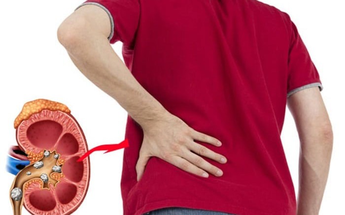 an man gay soi than 17740700825331116100421 10 0 447 700 crop 17765037859691012979927