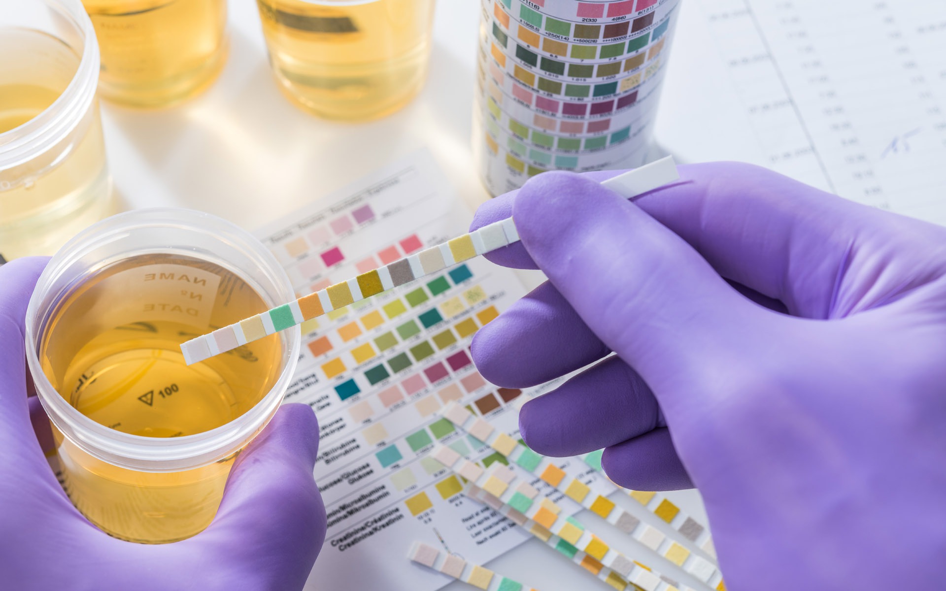 xet nghiem nuoc tieu 1706764053047867225315 0 0 1200 1920 crop 17766103381562141028542