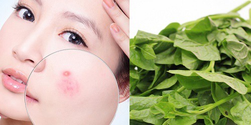 Cách dùng rau mồng tơi chữa lành da mụn trứng cá- Ảnh 1.