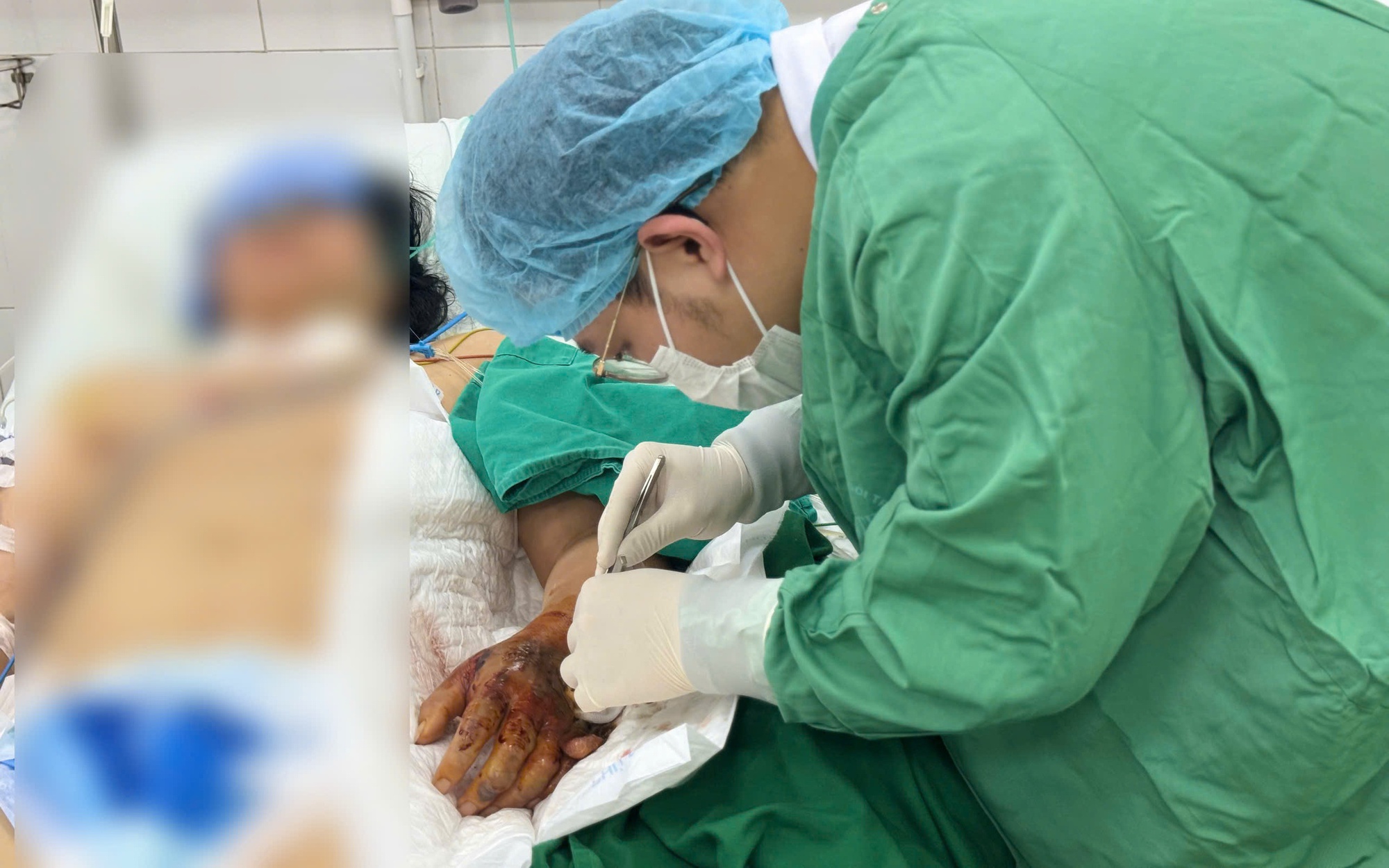 Một phụ nữ viêm màng não do nhiễm loại nấm 'giấu mặt' trong vỏ cây bạch đàn- Ảnh 1.