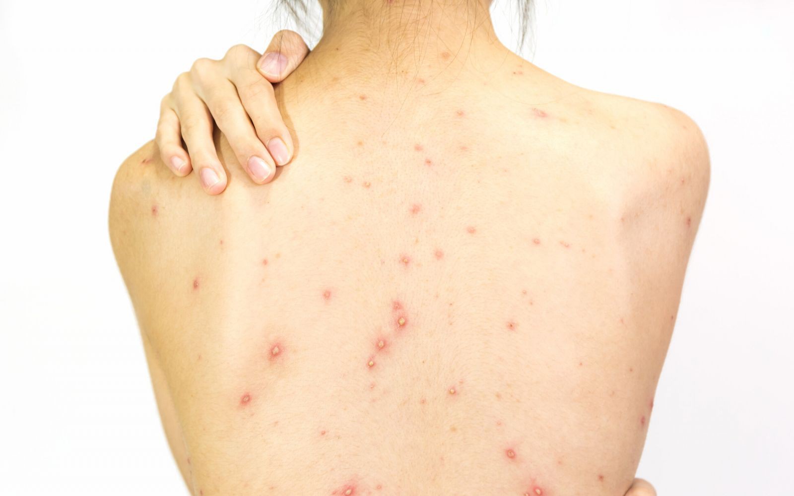 6c6ccfa3e381bf32737135fa6171524e1752785622 1776654109345 1776654111099670783736 0 0 1000 1600 crop 17766541549501110444927