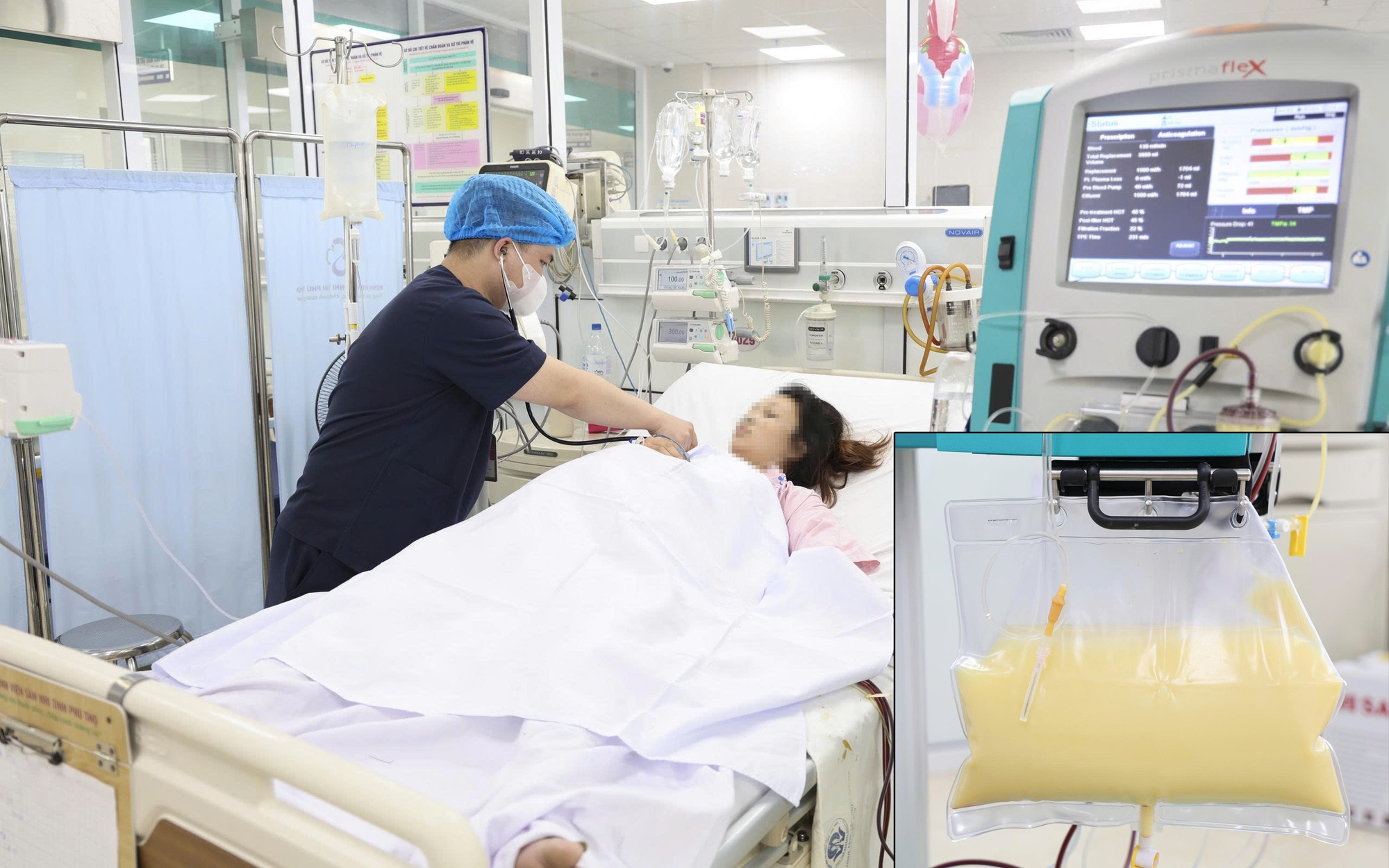 Cúm B không chỉ là cảm cúm thông thường, nhiều ca phải thở máy- Ảnh 3.