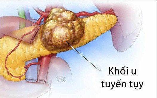 photo 1776770255707 1776770257404746625297 0 114 329 640 crop 1776770887645974848576