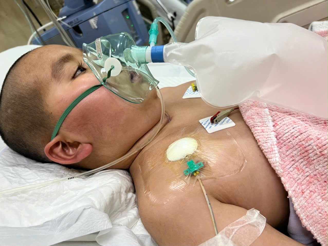 6 ca mổ liên tiếp vẫn chưa qua cửa tử, bé trai 11 tuổi và lời cầu xin của người mẹ đơn thân- Ảnh 1.