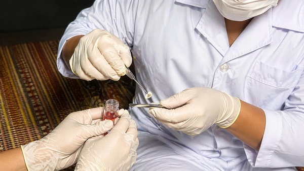 Ca hiến giác mạc đầu tiên tại Bệnh viện Đa khoa Bắc Ninh số 1- Ảnh 1.