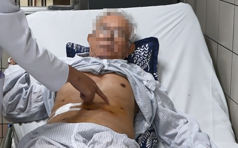 edit edit peutz jeghers 1742801403107738834382 177518421726387455272 464 428 954 1212 crop 1775184224053426581273