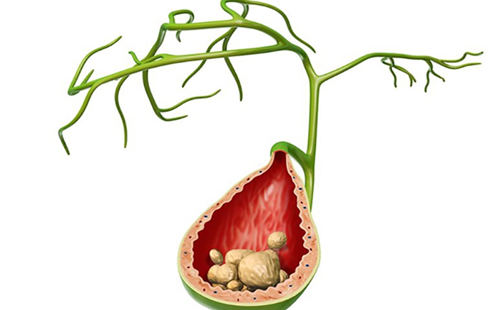 soi bun tui mat 17752050076811409937004 0 0 437 700 crop 17752050122931607862596