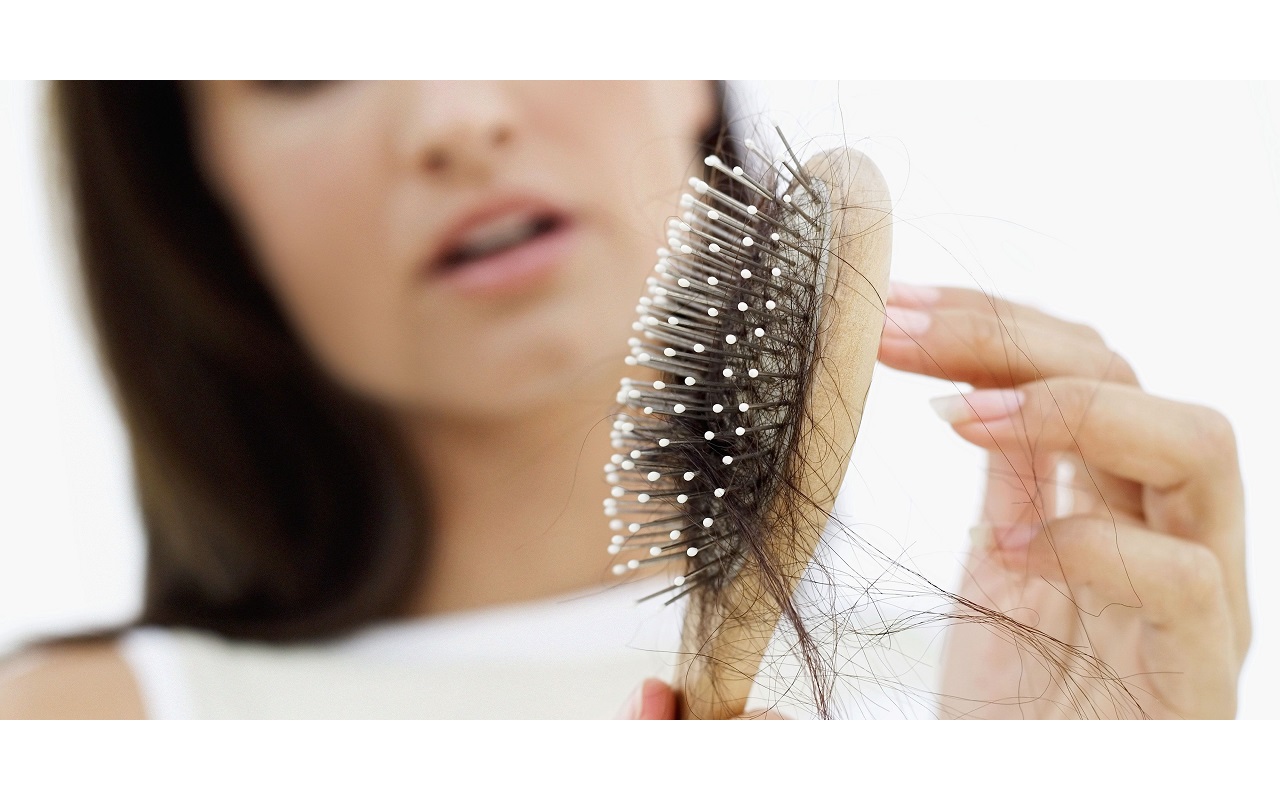 Rụng tóc sau sinh kéo dài: Khi nào không còn bình thường?- Ảnh 3.