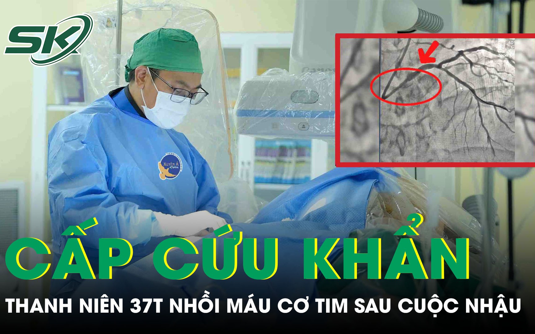 Hút thuốc lá nhiều năm, người đàn ông 45 tuổi suýt tử vong vì tắc cùng lúc 2 mạch vành nuôi tim- Ảnh 4. Sau cuộc nhậu, người đàn 37 tuổi bất ngờ lên cơn nhồi máu cơ tim phải cấp cứu khẩn