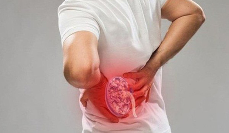 Tăng canxi máu có thể gây tổn thương thận- Ảnh 2.