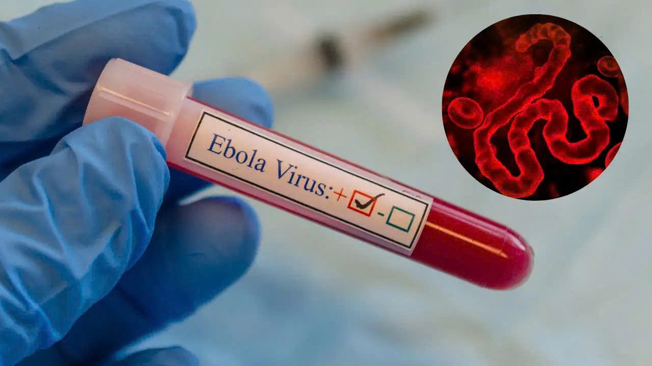 TPHCM tăng cường giám sát trước nguy cơ dịch Ebola xâm nhập