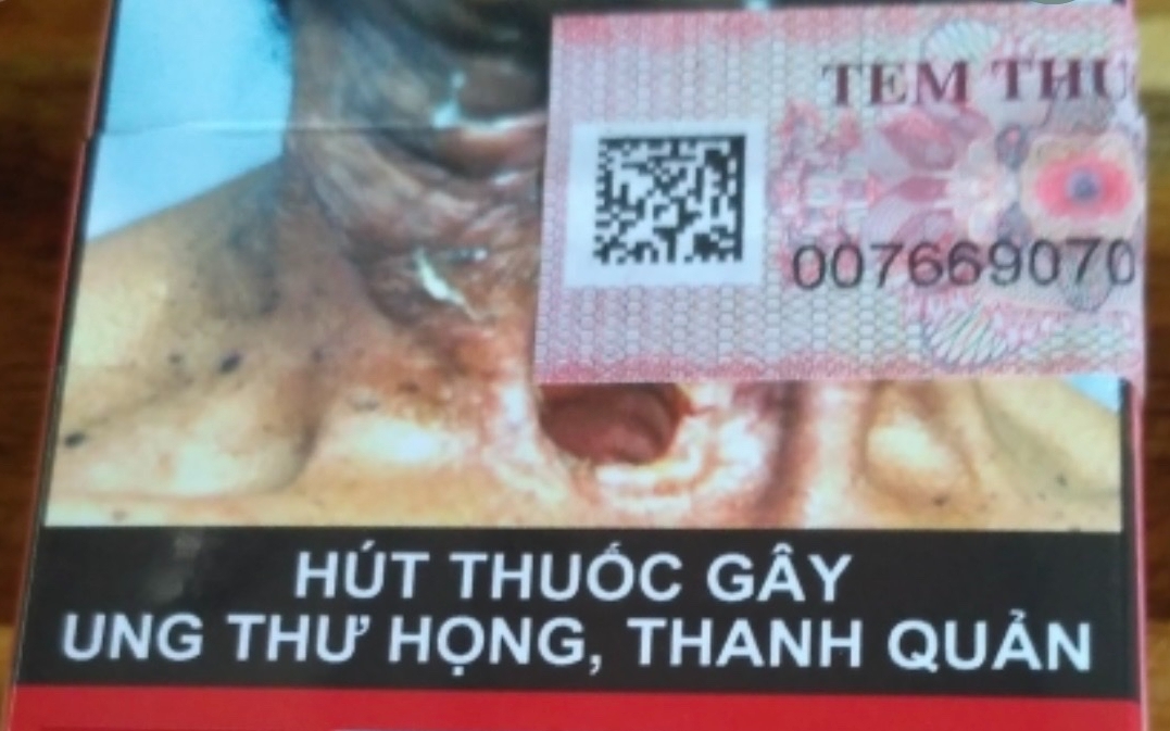 Thuốc lá “đốt” hơn 2% GDP mỗi năm, tạo gánh nặng kép lên y tế và môi trường- Ảnh 3.