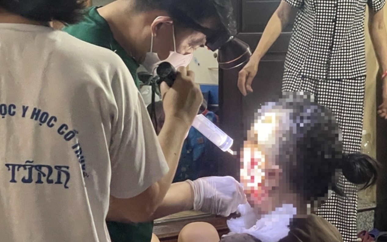 Công an Hà Nội vào cuộc vụ mổ khối u tại cơ sở chữa bệnh bằng nước- Ảnh 7. Sở Y tế Hà Nội nói gì về vụ mổ khối u tại cơ sở chữa bệnh bằng nước?