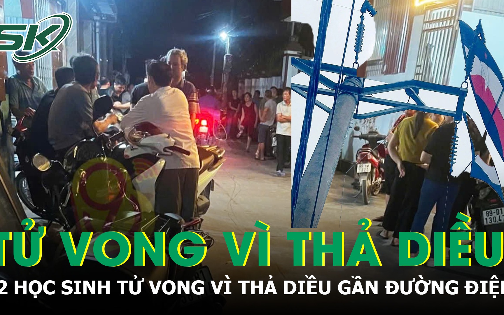 Người đàn ông mất dương vật sau bỏng điện cao thế được bác sĩ tái tạo kịp thời- Ảnh 4. Người đàn ông mất dương vật sau bỏng điện cao thế được bác sĩ tái tạo kịp thời- Ảnh 4.