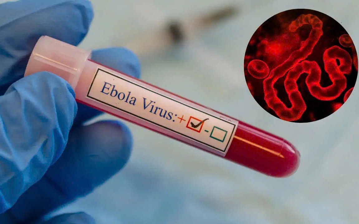 Quảng Trị siết kiểm dịch ngăn chặn dịch Ebola qua biên giới- Ảnh 4. WHO cảnh báo khẩn về Ebola, Bộ Y tế yêu cầu tăng cường giám sát, ngăn dịch xâm nhập