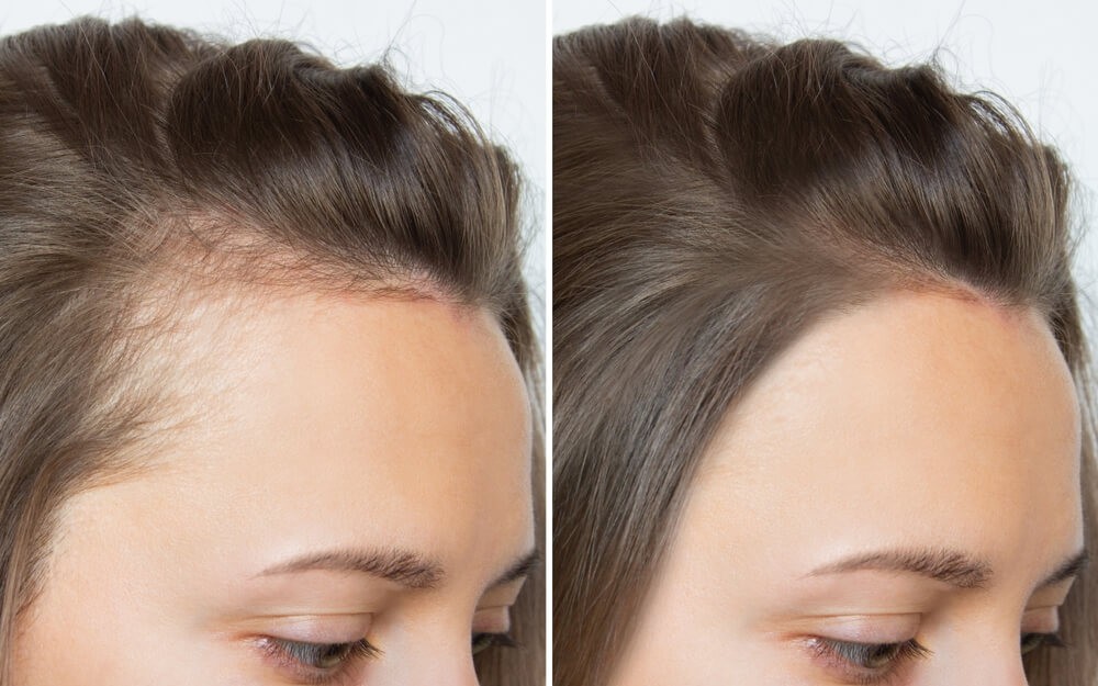 Những loại thực phẩm giàu biotin tự nhiên giúp tóc mọc nhanh chóng- Ảnh 4. Cách sử dụng dầu dừa cho tóc mọc nhanh