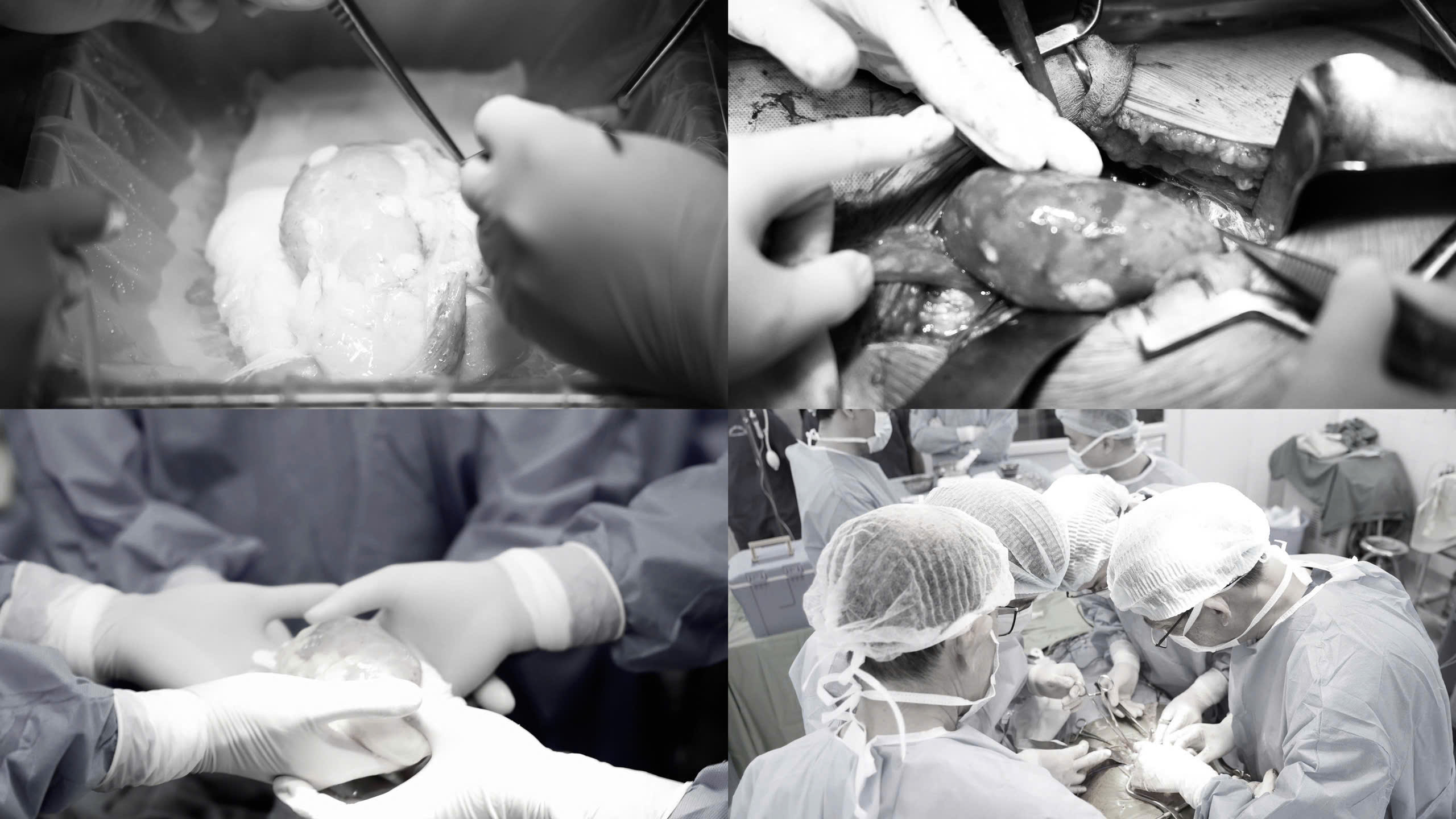 Bệnh viện Hữu nghị Việt Tiệp thực hiện ca ghép thận đầu tiên từ người hiến chết não- Ảnh 2. Bệnh viện Hữu nghị Việt Tiệp thực hiện ca ghép thận đầu tiên từ người hiến chết não- Ảnh 2.
