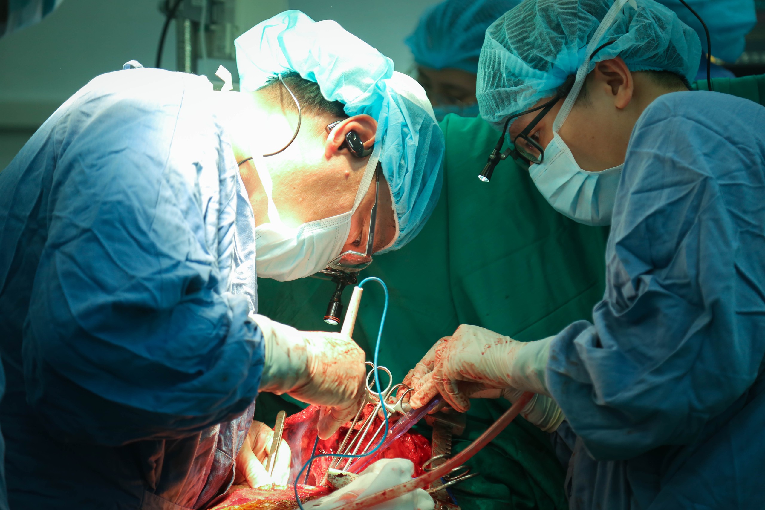Kỳ tích ghép tạng tại Việt Đức: 21 ca trong một tuần, viết tiếp hành trình hồi sinh- Ảnh 2. Kỳ tích ghép tạng tại Việt Đức: 21 ca trong một tuần, viết tiếp hành trình hồi sinh- Ảnh 2.