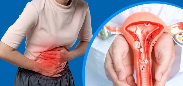 7 dấu hiệu thường gặp của lạc nội mạc tử cung chị em nên chú ý- Ảnh 1. 7 dấu hiệu thường gặp của lạc nội mạc tử cung chị em nên chú ý- Ảnh 1.