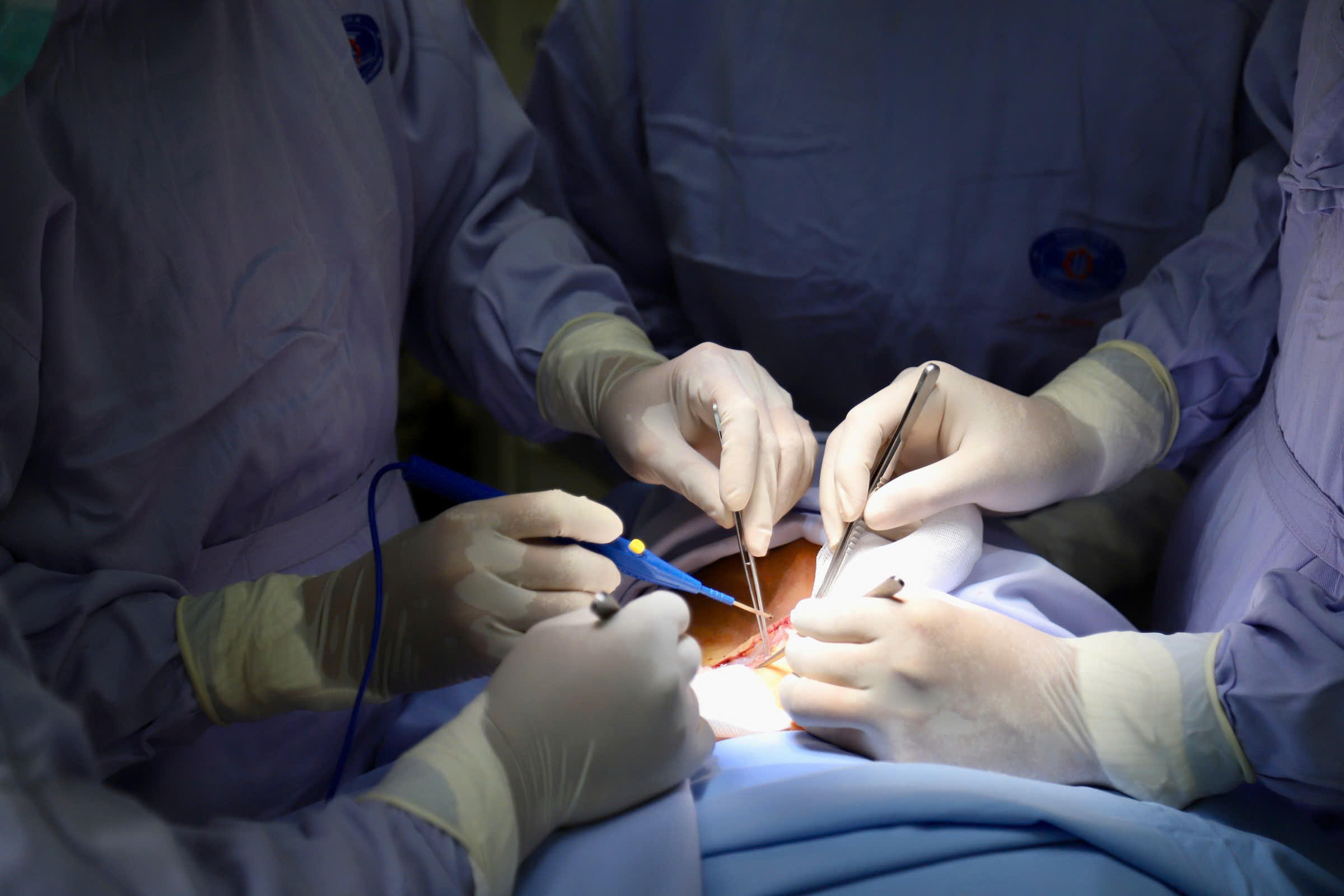 Ung thư lưỡi dễ nhầm nhiệt miệng: Bác sĩ cảnh báo dấu hiệu không nên chủ quan- Ảnh 1. Ung thư lưỡi dễ nhầm nhiệt miệng: Bác sĩ cảnh báo dấu hiệu không nên chủ quan- Ảnh 1.