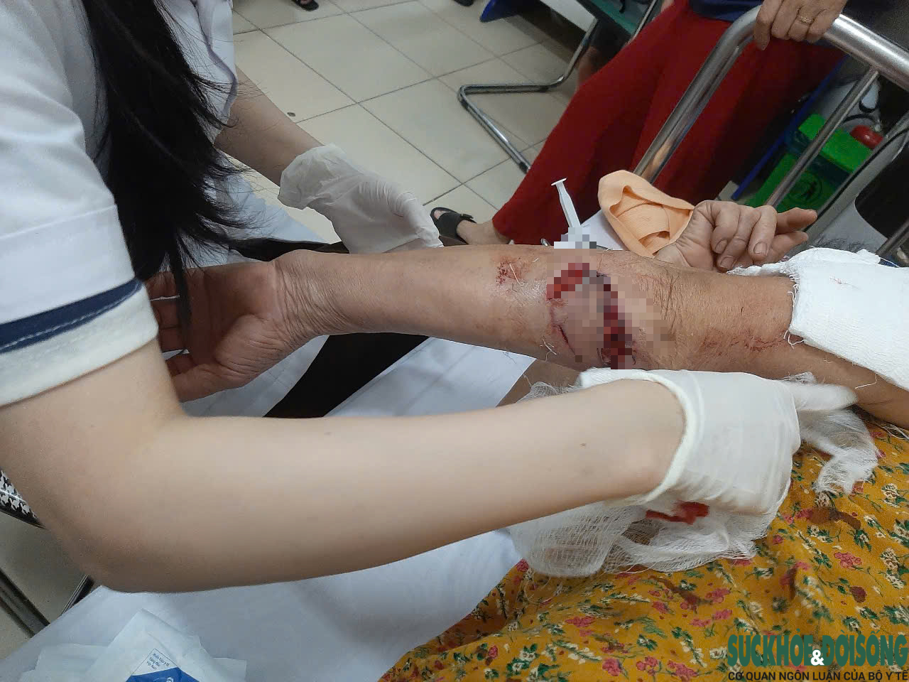 Nỗi ám ảnh mang tên chó thả rông- Ảnh 3. Nỗi ám ảnh mang tên chó thả rông- Ảnh 3.