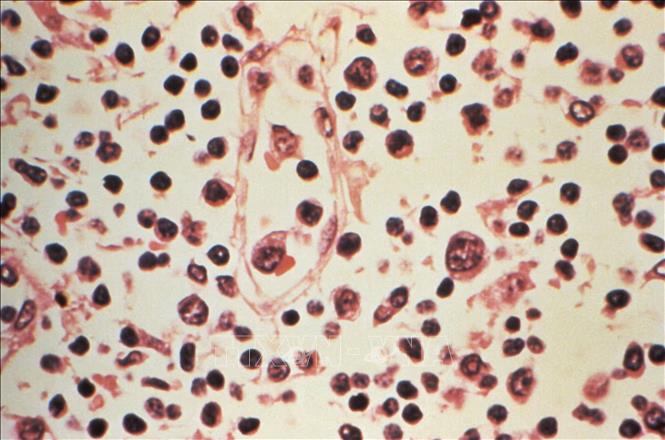 Đài Loan (Trung Quốc) ghi nhận 1 ca tử vong do nhiễm virus Hanta- Ảnh 1.