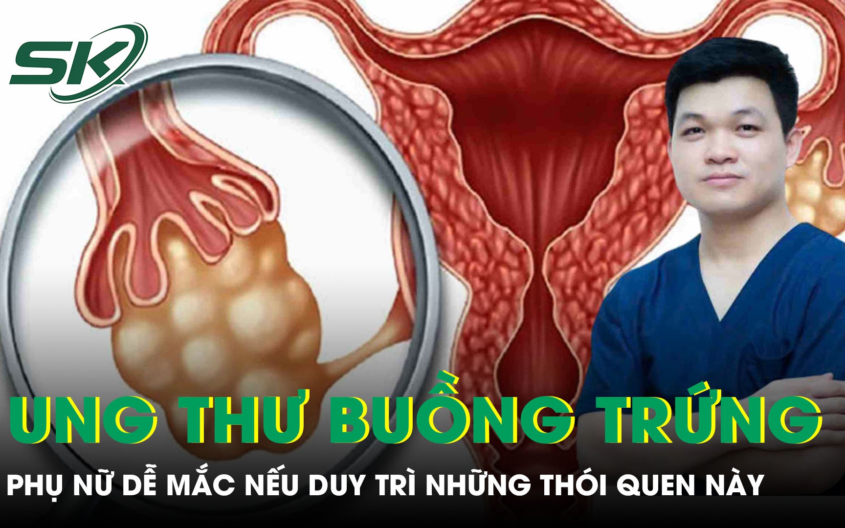 Chảy máu âm đạo bất thường, cảnh giác với ung thư buồng trứng - Ảnh 1.