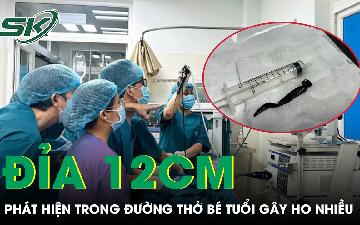 Cẩn trọng với con đỉa xâm nhập cơ thể khi tắm sông , suối mùa hè 2026 - Ảnh 2. Cẩn trọng với con đỉa xâm nhập cơ thể khi tắm sông , suối mùa hè 2026 - Ảnh 2.