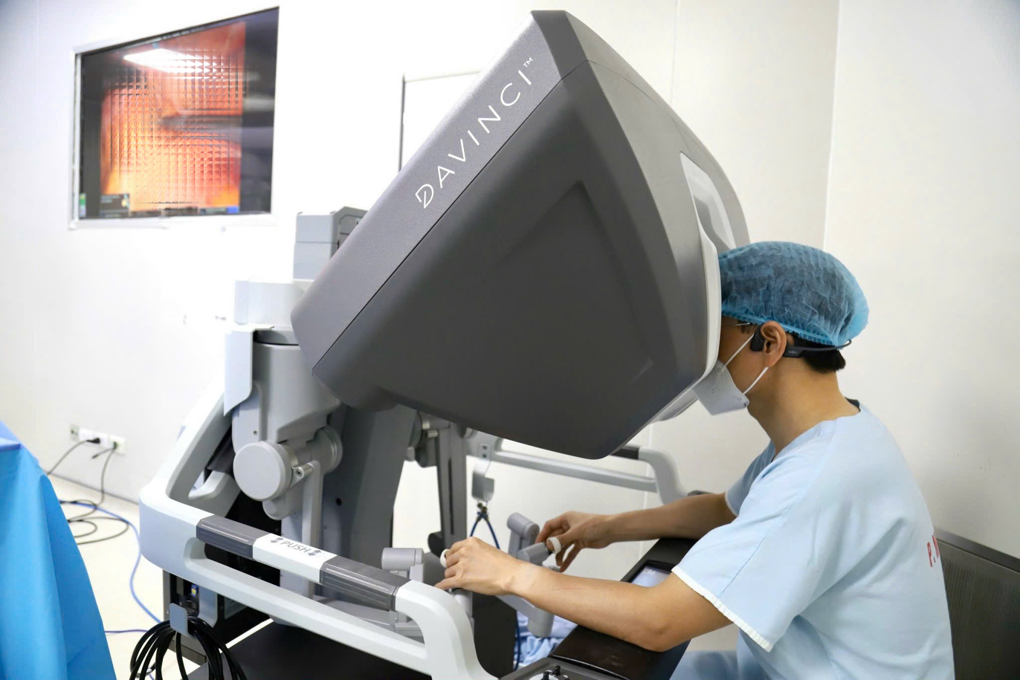 Ứng dụng robot Da Vinci Xi tại Bệnh viện K, tăng độ chính xác trong phẫu thuật ung thư thực quản- Ảnh 1. Ứng dụng robot Da Vinci Xi tại Bệnh viện K, tăng độ chính xác trong phẫu thuật ung thư thực quản- Ảnh 1.